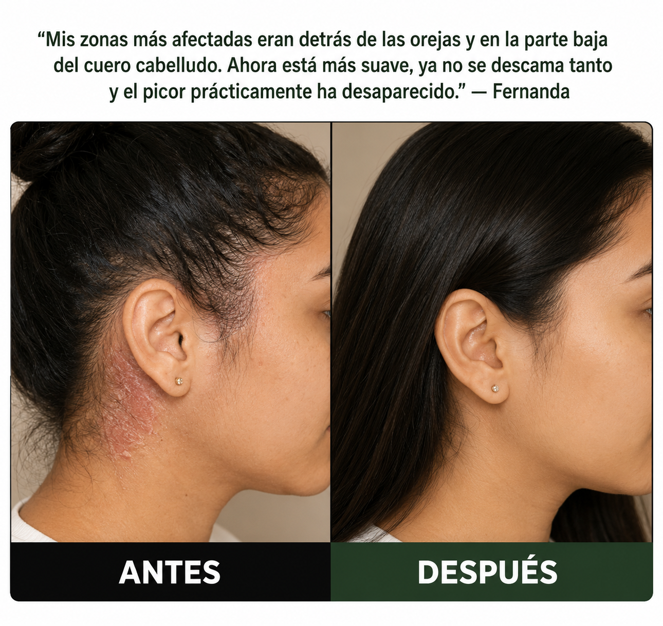 Exfoliante Capilar Natural Mertuka